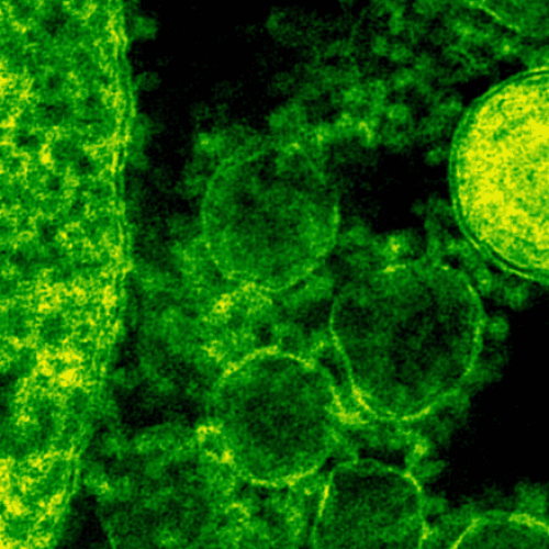 El SPP activa el protocolo de prevención contra la bacteria del streptococcus pyogenes